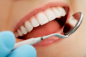 A close-up of a patient's open mouth during an exam, with a dentist using a mouth mirror to inspect the upper teeth.